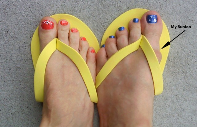 Pretty toenails