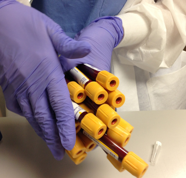 This picture was taken on the day my blood was drawn.