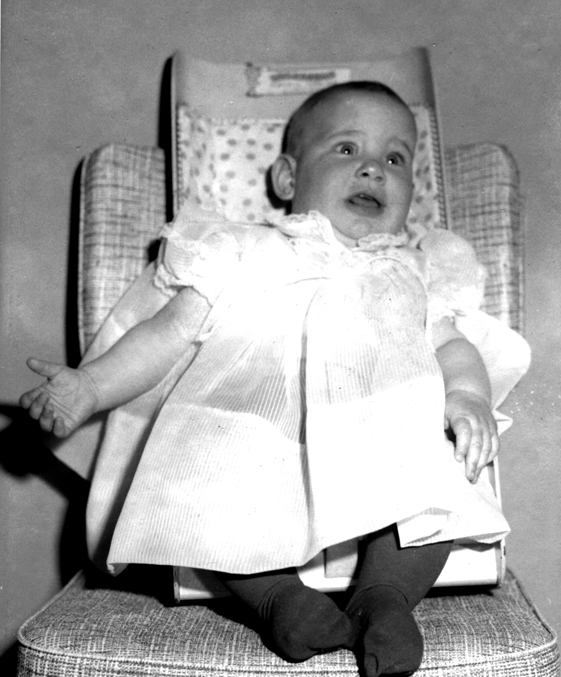 This baby picture of mine works perfectly to describe how my face must have looked before my adjustment.