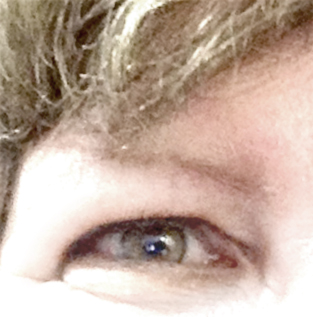 I can open my eyes again – somewhat.